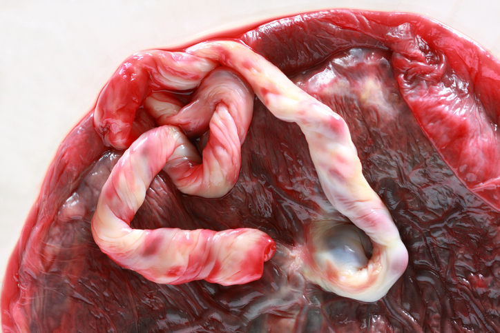 Takto vyzerá placenta po pôrode, anatomické foto